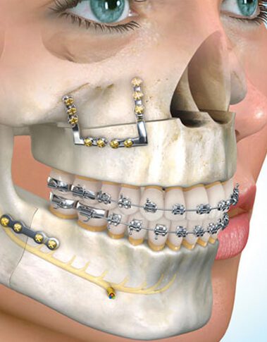 Cirugía oral en Baza